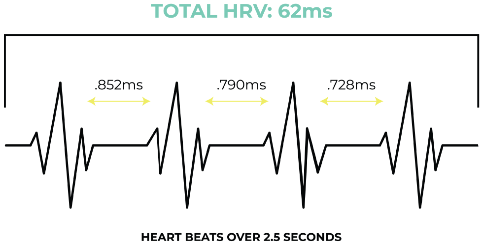 HRV chart