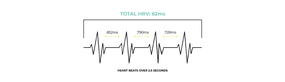 Diagram of heart rate variability